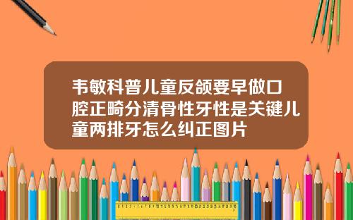 韦敏科普儿童反颌要早做口腔正畸分清骨性牙性是关键儿童两排牙怎么纠正图片