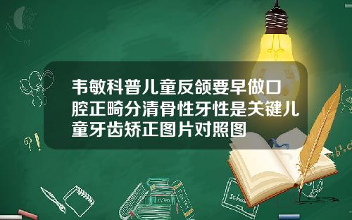 韦敏科普儿童反颌要早做口腔正畸分清骨性牙性是关键儿童牙齿矫正图片对照图